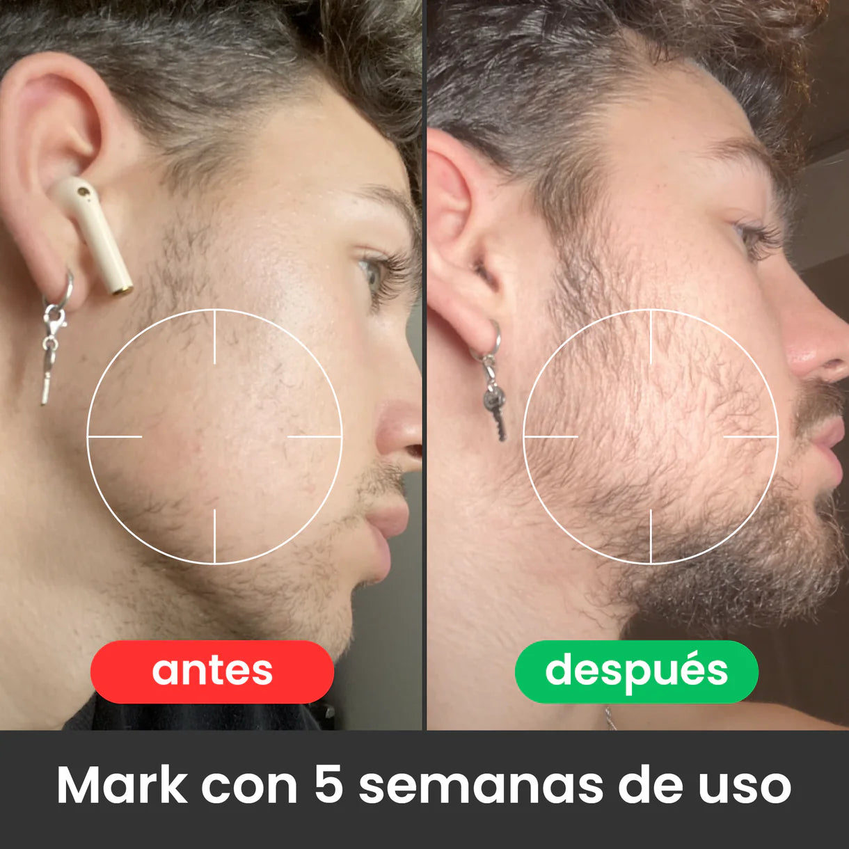 Bálsamo Apolo para Crecimiento de Barba Ultra Potente con Minoxidil 20% | 100mL