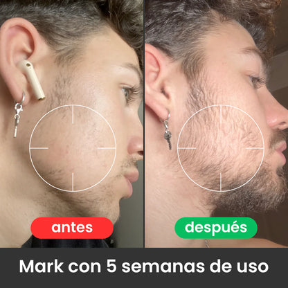 Bálsamo Apolo para Crecimiento de Barba Ultra Potente con Minoxidil 20% | 100mL