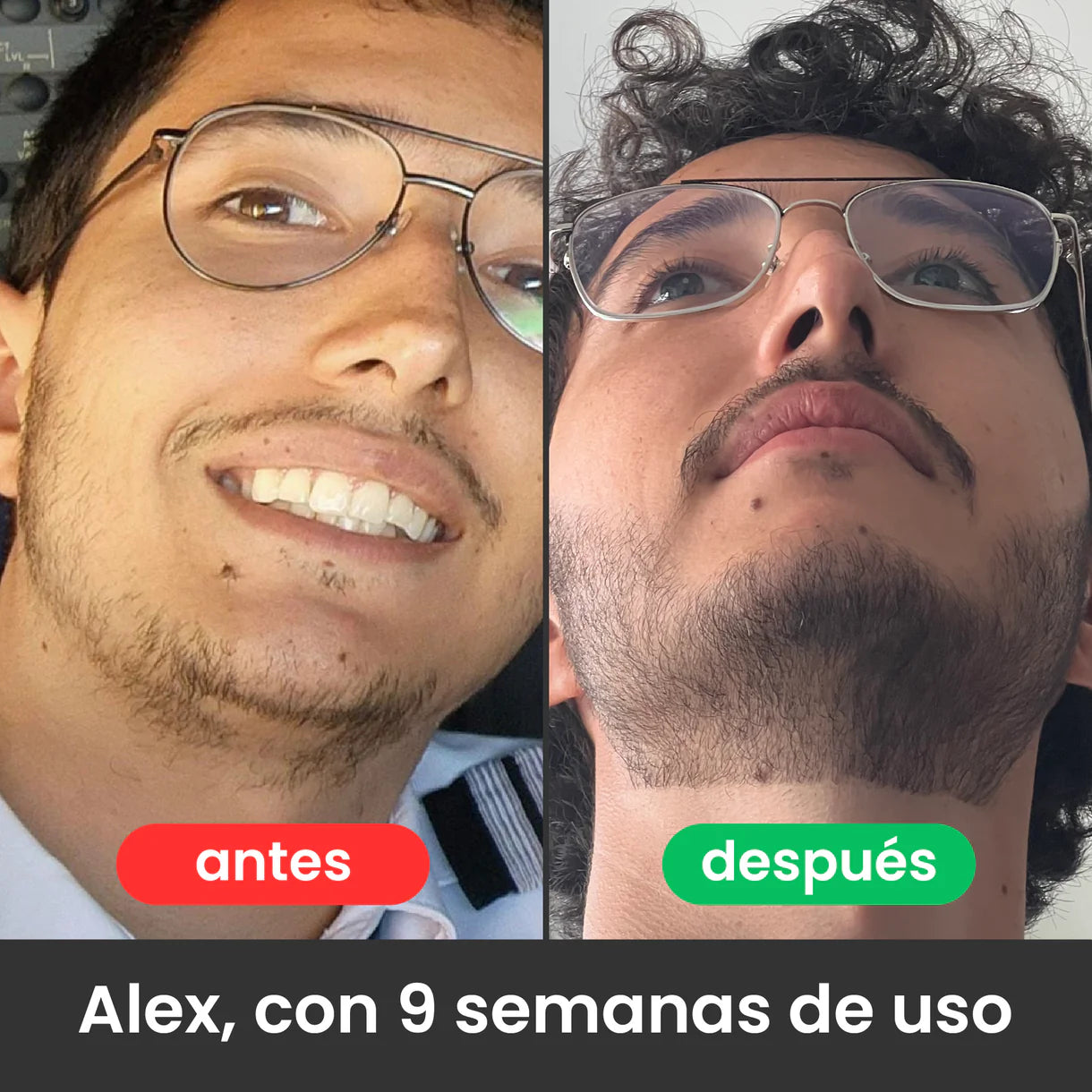 Bálsamo Apolo para Crecimiento de Barba Ultra Potente con Minoxidil 20% | 100mL