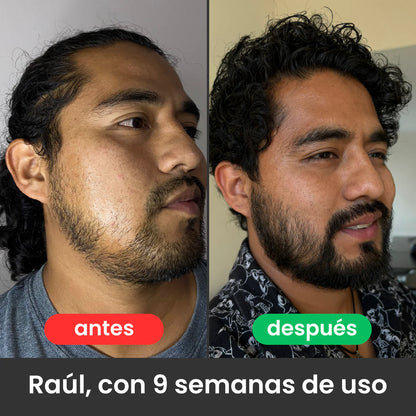 Bálsamo Apolo para Crecimiento de Barba Ultra Potente con Minoxidil 20% | 100mL